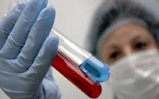 Бесплатно сдать тест на ВИЧ могут казахстанцы